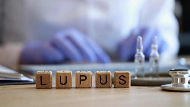 Gejala Lupus, Penyakit Autoimun yang Perlu Diwaspadai